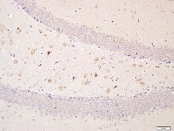 Optineurin Rabbit anti-Human, Polyclonal, Bioss 100 &mu;L; Unconjugated:Antibodies,