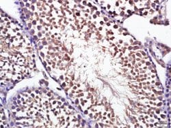 Optineurin Rabbit anti-Human, Polyclonal, Bioss 100 &mu;L; Unconjugated:Antibodies,