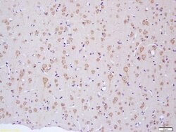 NF2/Neurofibromin 2 Rabbit anti-Human, Polyclonal, Bioss 100 &mu;L; Unconjugated:Antibodies,