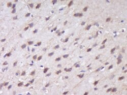 RUSC1 Rabbit anti-Human, Polyclonal, Bioss 100 &mu;L; Unconjugated:Antibodies,