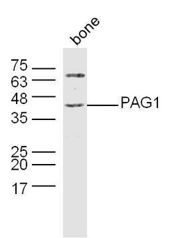 PAG1 Rabbit anti-Human, Polyclonal, Bioss 100 &mu;L; Unconjugated:Antibodies,