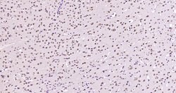 SAM68 Rabbit anti-Human, Polyclonal, Bioss 100 &mu;L; Unconjugated:Antibodies,