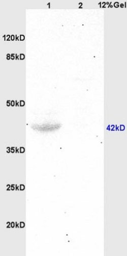 GPR30 Rabbit anti-Human, Polyclonal, Bioss 100 &mu;L; Unconjugated:Antibodies,