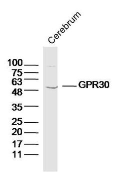 GPR30 Rabbit anti-Human, Polyclonal, Bioss 100 &mu;L; Unconjugated:Antibodies,