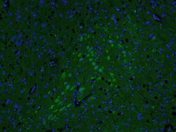 AKAP12/Gravin Rabbit anti-Human, Polyclonal, Bioss 100 &mu;L; Unconjugated:Antibodies,