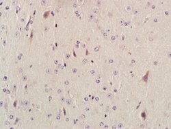 AKAP12/Gravin Rabbit anti-Human, Polyclonal, Bioss 100 &mu;L; Unconjugated:Antibodies,