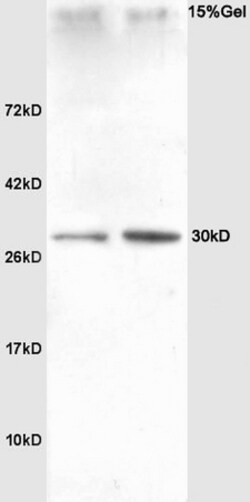 SLUG Rabbit anti-Human, Polyclonal, Bioss 100 &mu;L; Unconjugated:Antibodies,