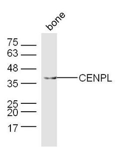 CENPL Rabbit anti-Human, Polyclonal, Bioss 100 &mu;L; Unconjugated:Antibodies,