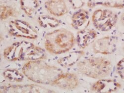 CD13/APN/ANPEN Rabbit anti-Human, Polyclonal, Bioss 100 &mu;L; Unconjugated:Antibodies,