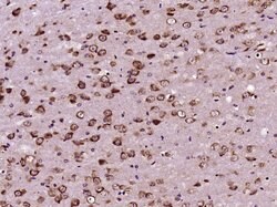 CEP290 Rabbit anti-Human, Polyclonal, Bioss 100 &mu;L; Unconjugated:Antibodies,