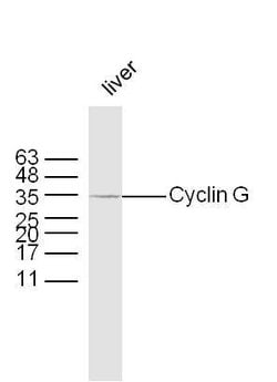 Cyclin G Rabbit anti-Human, Polyclonal, Bioss 100 &mu;L; Unconjugated:Antibodies,