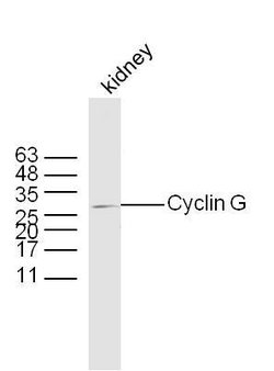 Cyclin G Rabbit anti-Human, Polyclonal, Bioss 100 &mu;L; Unconjugated:Antibodies,