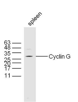 Cyclin G Rabbit anti-Human, Polyclonal, Bioss 100 &mu;L; Unconjugated:Antibodies,