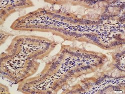CISD1 Rabbit anti-Human, Polyclonal, Bioss 100 μL; Unconjugated:Antibodies,