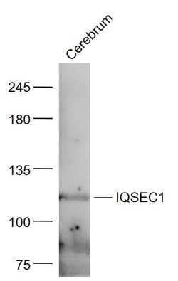 GEP100/IQSEC1 Rabbit anti-Human, Polyclonal, Bioss 100 &mu;L; Unconjugated:Antibodies,