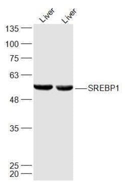 SREBP-1/2 Rabbit anti-Human, Polyclonal, Bioss 100 &mu;L; Unconjugated:Antibodies,