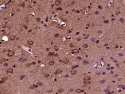 CRB2 Rabbit anti-Human, Polyclonal, Bioss 100 &mu;L; Unconjugated:Antibodies,
