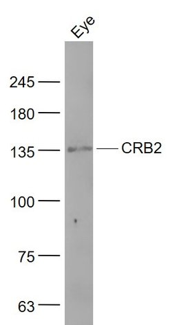CRB2 Rabbit anti-Human, Polyclonal, Bioss 100 &mu;L; Unconjugated:Antibodies,