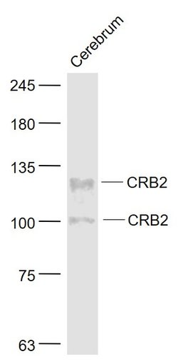 CRB2 Rabbit anti-Human, Polyclonal, Bioss 100 &mu;L; Unconjugated:Antibodies,