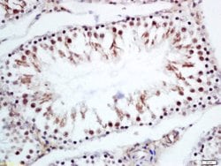 CRNKL1 Rabbit anti-Human, Polyclonal, Bioss 100 &mu;L; Unconjugated:Antibodies,