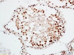 CRNKL1 Rabbit anti-Human, Polyclonal, Bioss 100 &mu;L; Unconjugated:Antibodies,