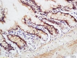 CRNKL1 Rabbit anti-Human, Polyclonal, Bioss 100 &mu;L; Unconjugated:Antibodies,