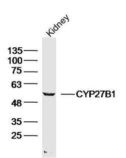 CYP27B1 Rabbit anti-Human, Polyclonal, Bioss 100 &mu;L; Unconjugated:Antibodies,
