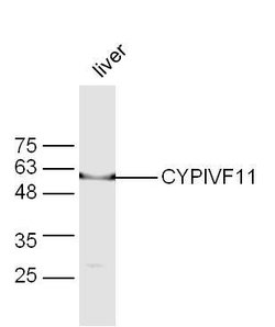 CYPIVF11 Rabbit anti-Human, Polyclonal, Bioss 100 &mu;L; Unconjugated:Antibodies,