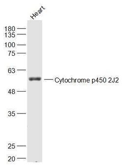 Cytochrome p450 2J2 Rabbit anti-Human, Polyclonal, Bioss 100 &mu;L; Unconjugated:Antibodies,