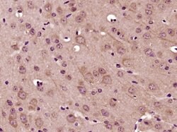 MADD Rabbit anti-Human, Polyclonal, Bioss 100 &mu;L; Unconjugated:Antibodies,