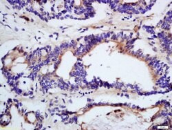 DHDH Rabbit anti-Human, Polyclonal, Bioss 100 &mu;L; Unconjugated:Antibodies,