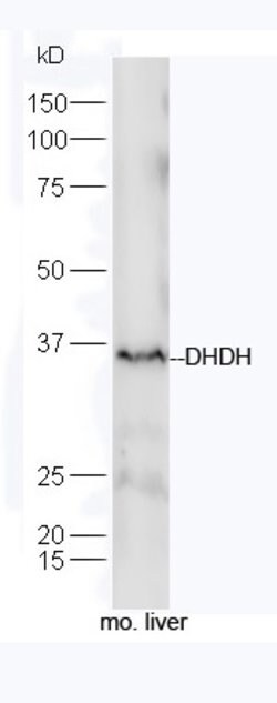 DHDH Rabbit anti-Human, Polyclonal, Bioss 100 &mu;L; Unconjugated:Antibodies,