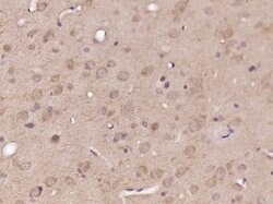 DNASE1L2 Rabbit anti-Human, Polyclonal, Bioss 100 &mu;L; Unconjugated:Antibodies,