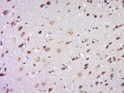 DPAGT1 Rabbit anti-Human, Polyclonal, Bioss 100 &mu;L; Unconjugated:Antibodies,