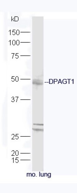 DPAGT1 Rabbit anti-Human, Polyclonal, Bioss 100 &mu;L; Unconjugated:Antibodies,