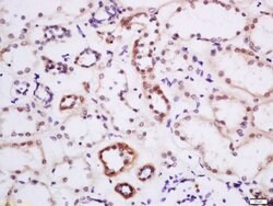 DTX3L Rabbit anti-Human, Polyclonal, Bioss 100 &mu;L; Unconjugated:Antibodies,