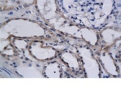 HIF2 alpha Rabbit anti-Human, Polyclonal, Bioss 100 &mu;L; Unconjugated:Antibodies,