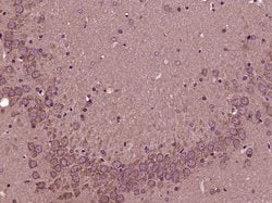 eIF4A2 Rabbit anti-Human, Polyclonal, Bioss 100 &mu;L; Unconjugated:Antibodies,