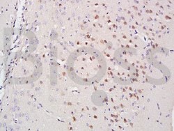 A2AR/Adenosine A2a receptor Rabbit anti-Human, Polyclonal, Bioss 100 &mu;L | Buy Online | Bioss | Fisher Scientific