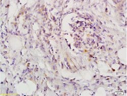 LIFR/CD118 Rabbit anti-Human, Polyclonal, Bioss 100 &mu;L; Unconjugated:Antibodies,