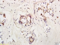 LIFR/CD118 Rabbit anti-Human, Polyclonal, Bioss 100 &mu;L; Unconjugated:Antibodies,