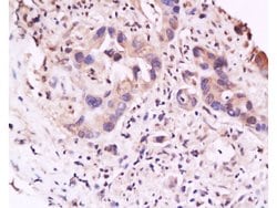 IL-23R Rabbit anti-Human, Polyclonal, Bioss 100 μL; Unconjugated:Antibodies,