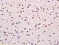 VDAC Rabbit anti-Human, Polyclonal, Bioss 100 &mu;L; Unconjugated:Antibodies,