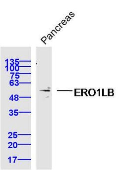 ERO1LB Rabbit anti-Human, Polyclonal, Bioss 100 &mu;L; Unconjugated:Antibodies,