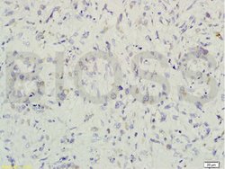 Gremlin 1 Rabbit anti-Human, Polyclonal, Bioss 100 &mu;L; Unconjugated:Antibodies,