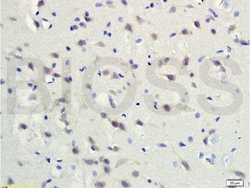Gremlin 1 Rabbit anti-Human, Polyclonal, Bioss 100 &mu;L; Unconjugated:Antibodies,
