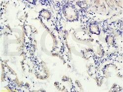 Gremlin 1 Rabbit anti-Human, Polyclonal, Bioss 100 &mu;L; Unconjugated:Antibodies,