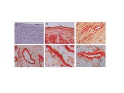Gremlin 1 Rabbit anti-Human, Polyclonal, Bioss 100 &mu;L; Unconjugated:Antibodies,