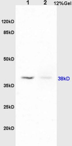 PAFR Rabbit anti-Human, Polyclonal, Bioss 100 &mu;L; Unconjugated:Antibodies,