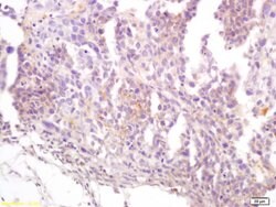 CD22/BLCAM Rabbit anti-Human, Polyclonal, Bioss 100 &mu;L; Unconjugated:Antibodies,